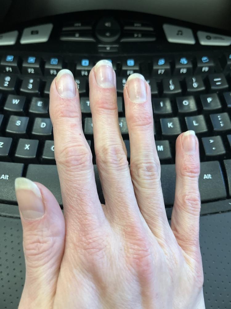 Collagen + Biotin Gummies - Customer Photo From Allison R.
